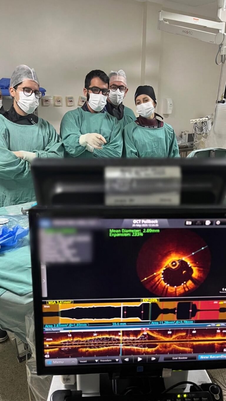 Procedimento guiado por imagem intravascular (OCT) em sala de hemodinâmica